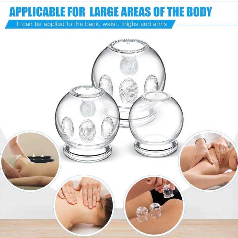 كاسه حجامه قزاز