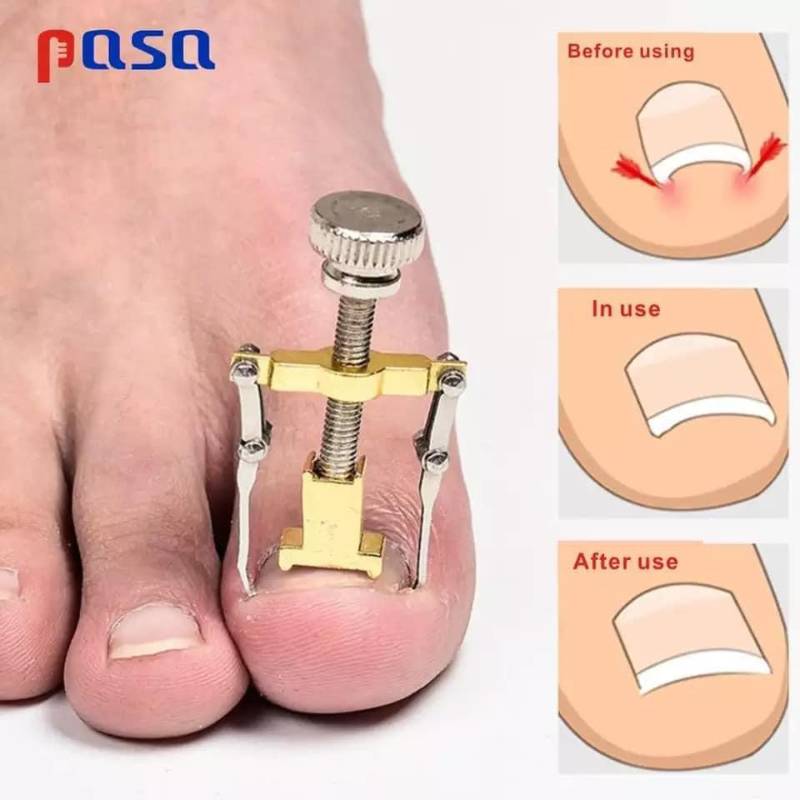 اداة تصحيح اظافر القدم